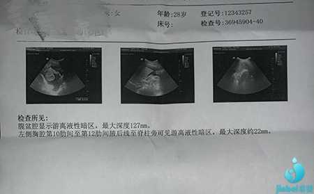 泰国做代孕医院,泰国做试管婴儿过程痛苦吗?
